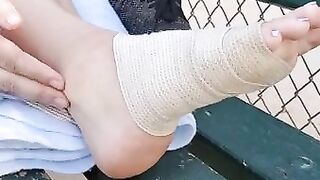 Painful Sprained Ankle ♡Onlyfans Pedipanty7 Preview♡