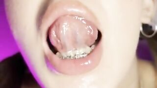 Mouth teasing. Sloppy girl with braces