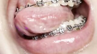 Mouth teasing. Sloppy girl with braces