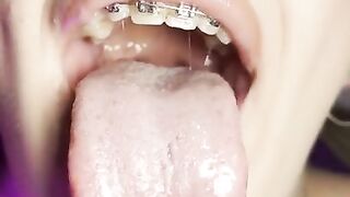 Mouth teasing. Sloppy girl with braces