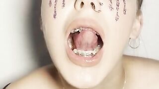 Sloppy ahegao by girl with braces. Spit fetish