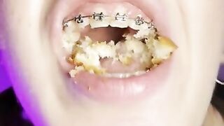 Food crush. Girl with braces chewing food