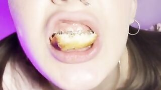 Food crush. Girl with braces chewing food