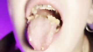 Food crush. Girl with braces chewing food