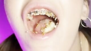 Food crush. Girl with braces chewing food