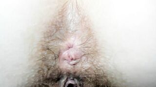 Extra cloused wink hairy asshole